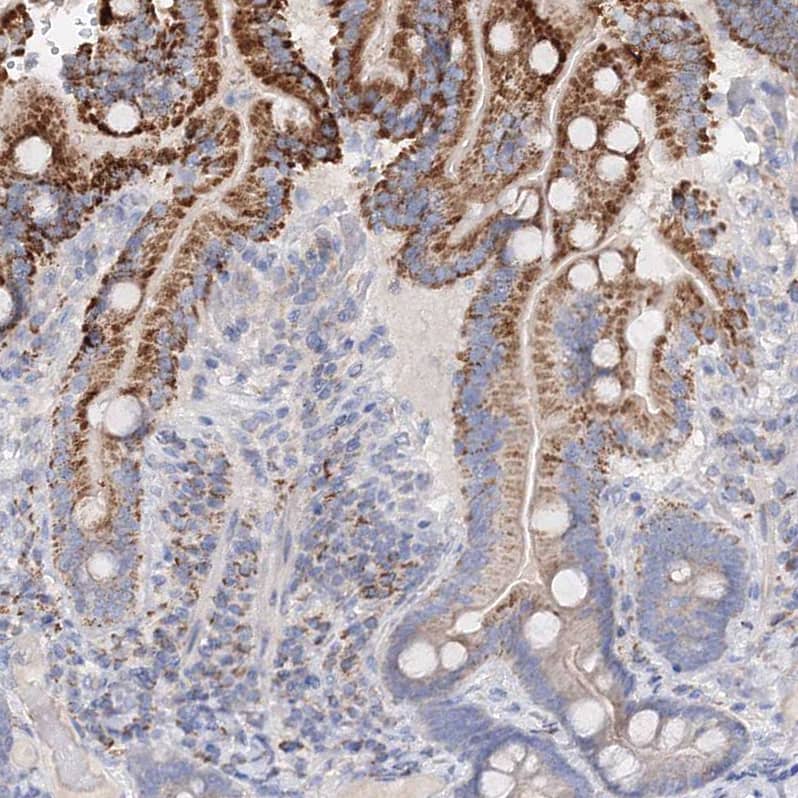 Glutaminase Antibody - BSA Free Immunohistochemistry-Paraffin: Glutaminase Antibody [NBP1-89766]