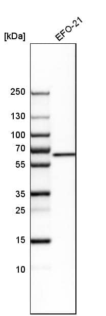 Glutaminase Antibody - BSA Free Western Blot: Glutaminase Antibody - BSA Free [NBP1-89766]