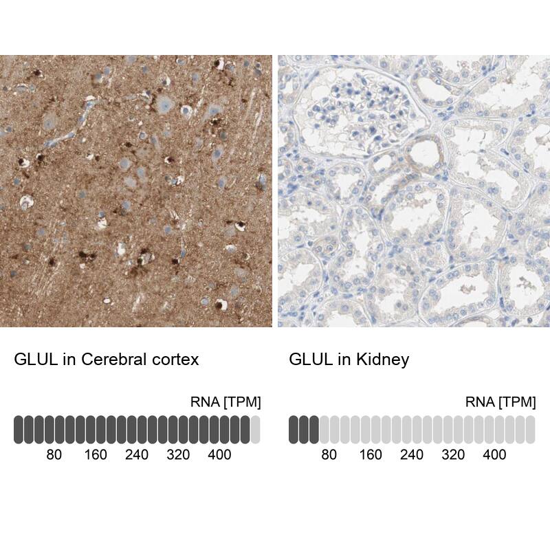 Glutamine Synthetase Antibody - BSA Free Immunohistochemistry-Paraffin: Glutamine Synthetase Antibody - BSA Free [NBP1-89767]