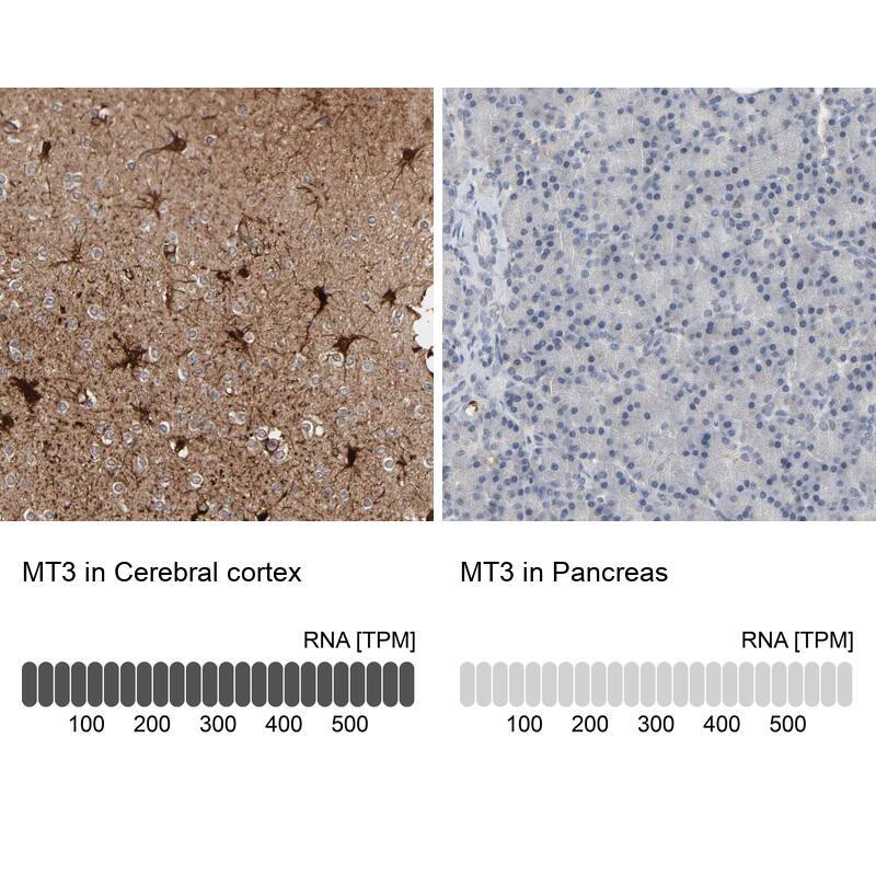 Metallothionein-3 Antibody - BSA Free Immunohistochemistry-Paraffin: Metallothionein-3 Antibody - BSA Free [NBP1-89772]