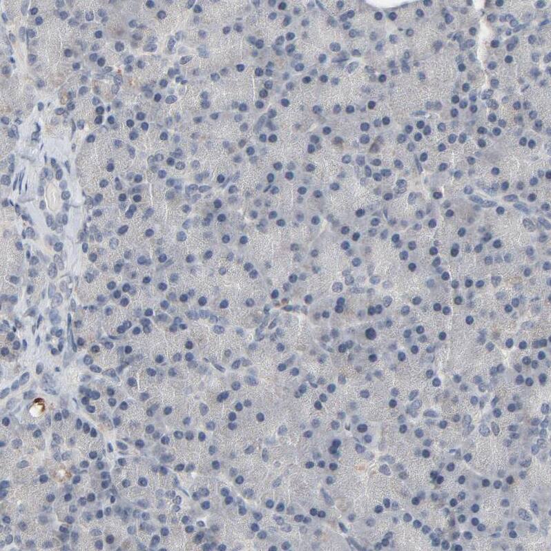 Metallothionein-3 Antibody - BSA Free Immunohistochemistry-Paraffin: Metallothionein-3 Antibody - BSA Free [NBP1-89772]