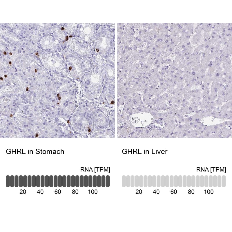 Ghrelin/Obestatin Antibody - BSA Free Immunohistochemistry-Paraffin: Ghrelin/Obestatin Antibody - BSA Free [NBP1-89773]