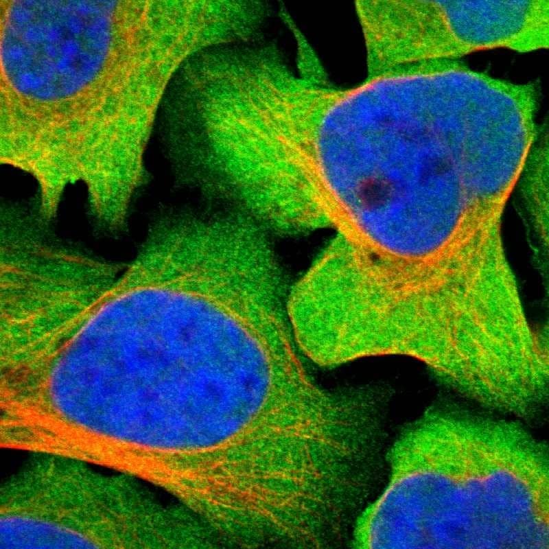GFR alpha-3/GDNF R alpha-3 Antibody - BSA Free Immunocytochemistry/ Immunofluorescence: GFR alpha-3/GDNF R alpha-3 Antibody [NBP1-89774]