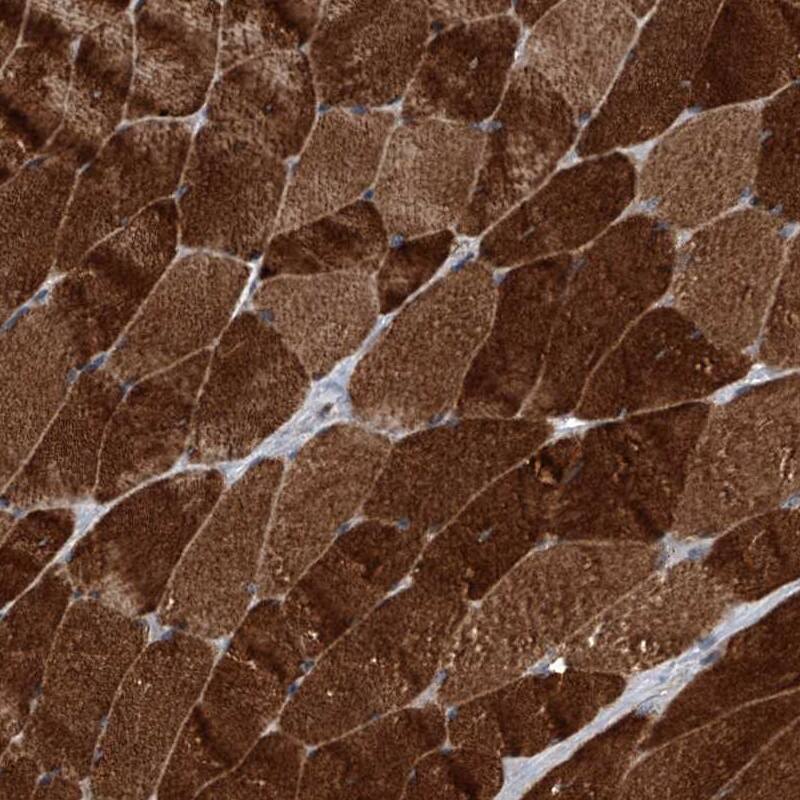 TRIM8 Antibody - BSA Free Immunohistochemistry-Paraffin: TRIM8 Antibody - BSA Free [NBP1-89776]