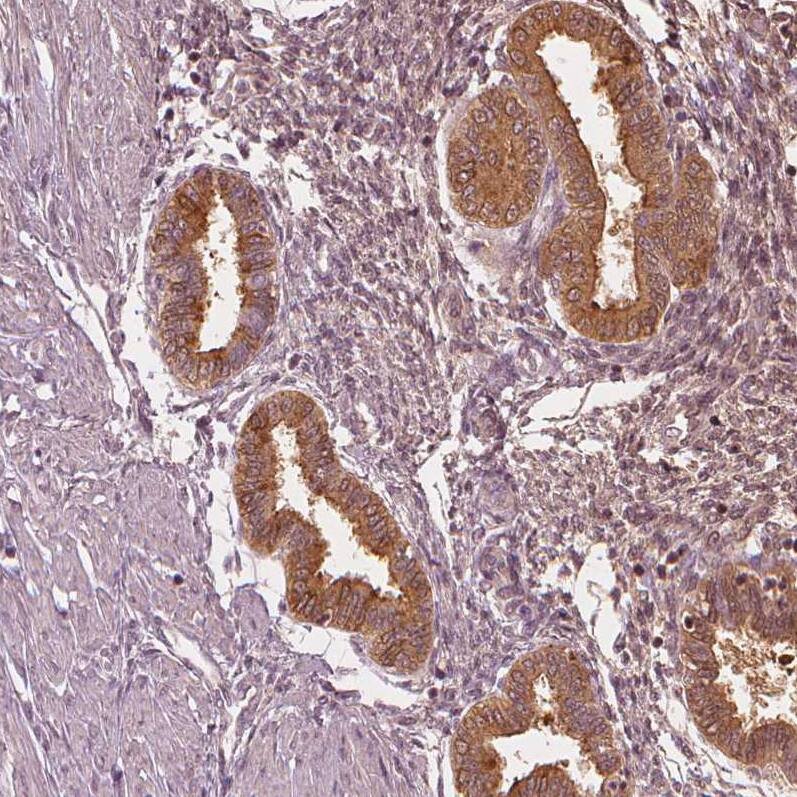 PP14/Glycodelin Antibody - BSA Free Immunohistochemistry-Paraffin: PP14/Glycodelin Antibody - BSA Free [NBP1-89781]