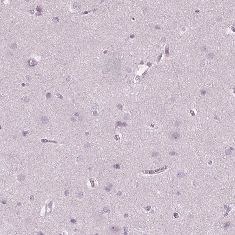 PP14/Glycodelin Antibody - BSA Free Immunohistochemistry-Paraffin: PP14/Glycodelin Antibody - BSA Free [NBP1-89781]