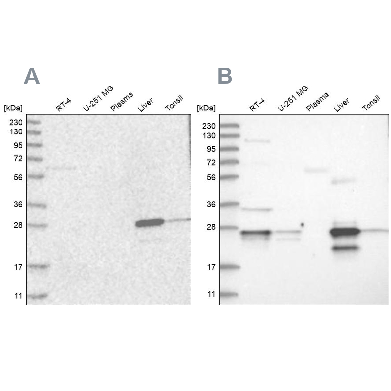 Grancalcin Antibody - BSA Free Western Blot: Grancalcin Antibody - BSA Free [NBP1-89785]