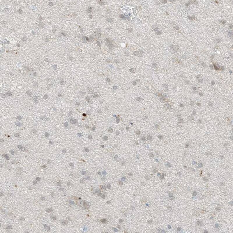 Grancalcin Antibody - BSA Free Immunohistochemistry-Paraffin: Grancalcin Antibody - BSA Free [NBP1-89785]