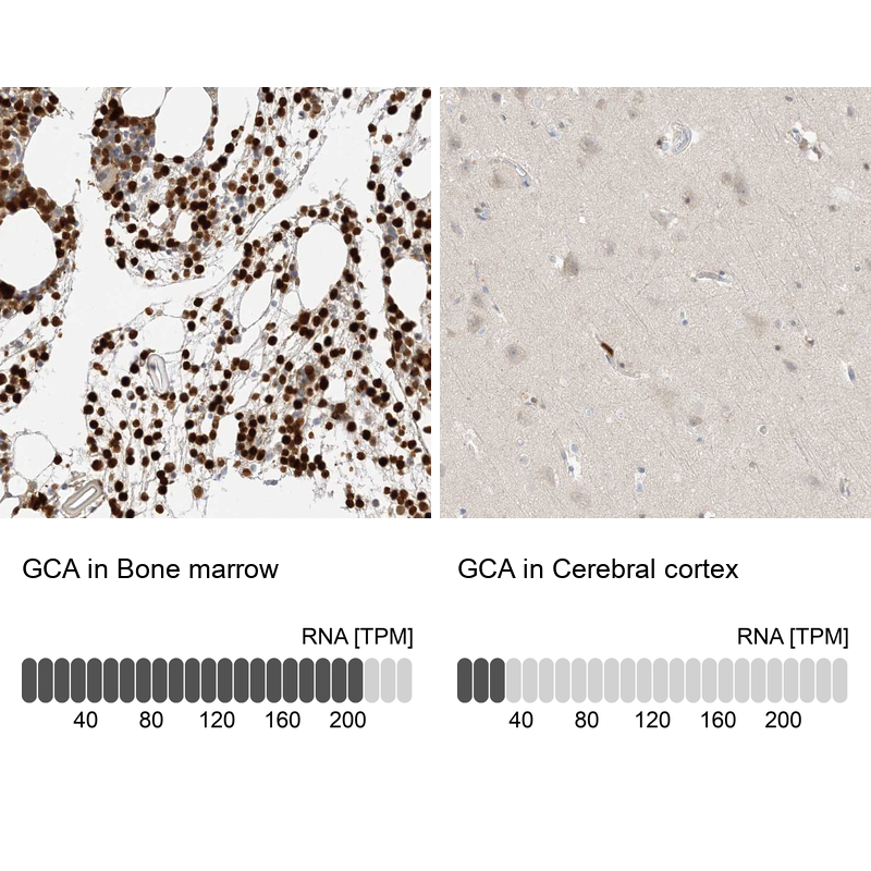 Grancalcin Antibody - BSA Free Immunohistochemistry-Paraffin: Grancalcin Antibody - BSA Free [NBP1-89786]