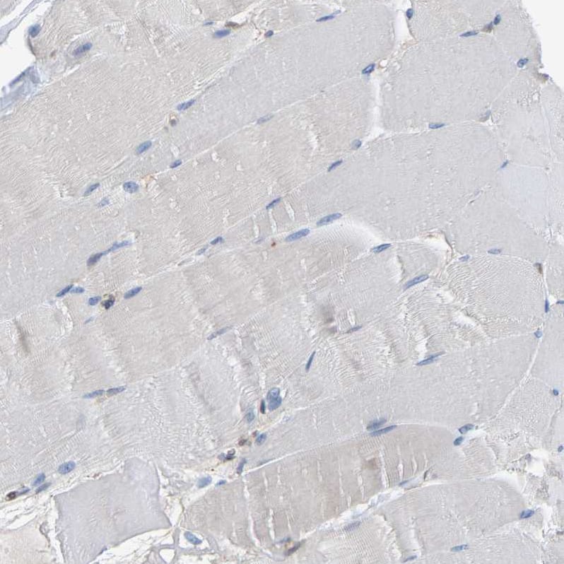 Myotrophin Antibody - BSA Free Immunohistochemistry-Paraffin: Myotrophin Antibody [NBP1-89787]