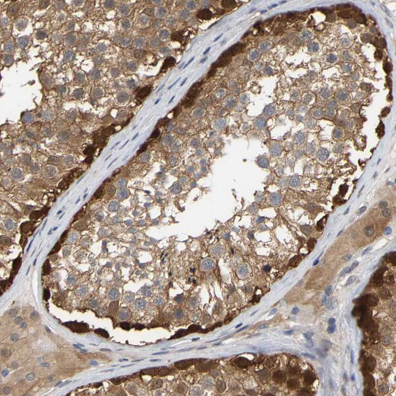 Myotrophin Antibody - BSA Free Immunohistochemistry-Paraffin: Myotrophin Antibody [NBP1-89787]