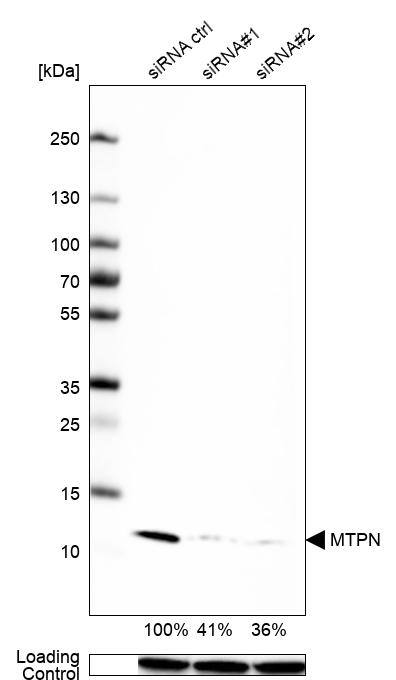Myotrophin Antibody - BSA Free Western Blot: Myotrophin Antibody - BSA Free [NBP1-89787]