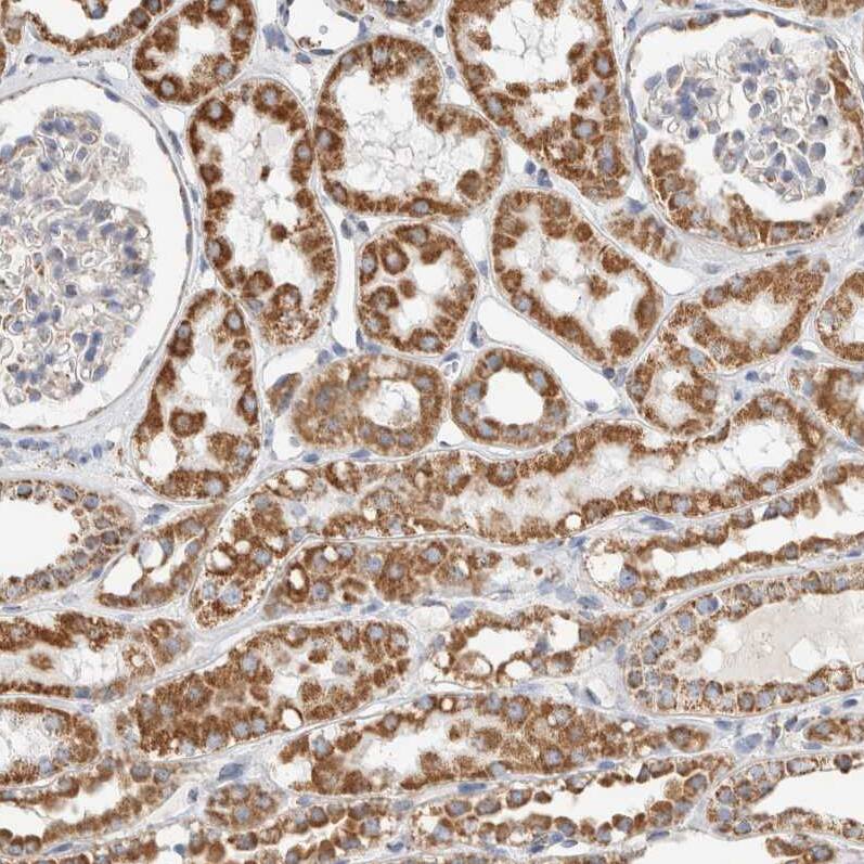 HABP1/C1QBP/GC1q R Antibody - BSA Free Immunohistochemistry-Paraffin: HABP1/C1QBP/GC1q R Antibody - BSA Free [NBP1-89790]