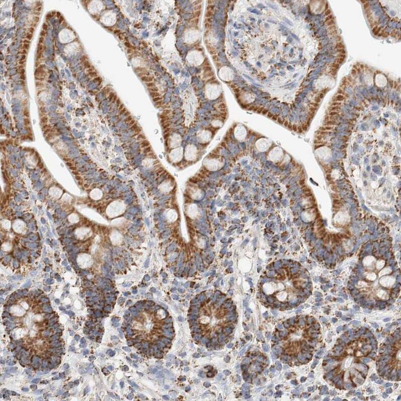 HABP1/C1QBP/GC1q R Antibody - BSA Free Immunohistochemistry-Paraffin: HABP1/C1QBP/GC1q R Antibody - BSA Free [NBP1-89790]