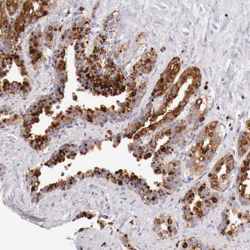 alpha-Galactosidase A/GLA Antibody - BSA Free Immunohistochemistry-Paraffin: alpha-Galactosidase A/GLA Antibody - BSA Free [NBP1-89796]