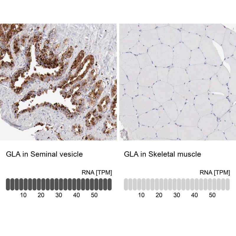 alpha-Galactosidase A/GLA Antibody - BSA Free Immunohistochemistry-Paraffin: alpha-Galactosidase A/GLA Antibody - BSA Free [NBP1-89796]