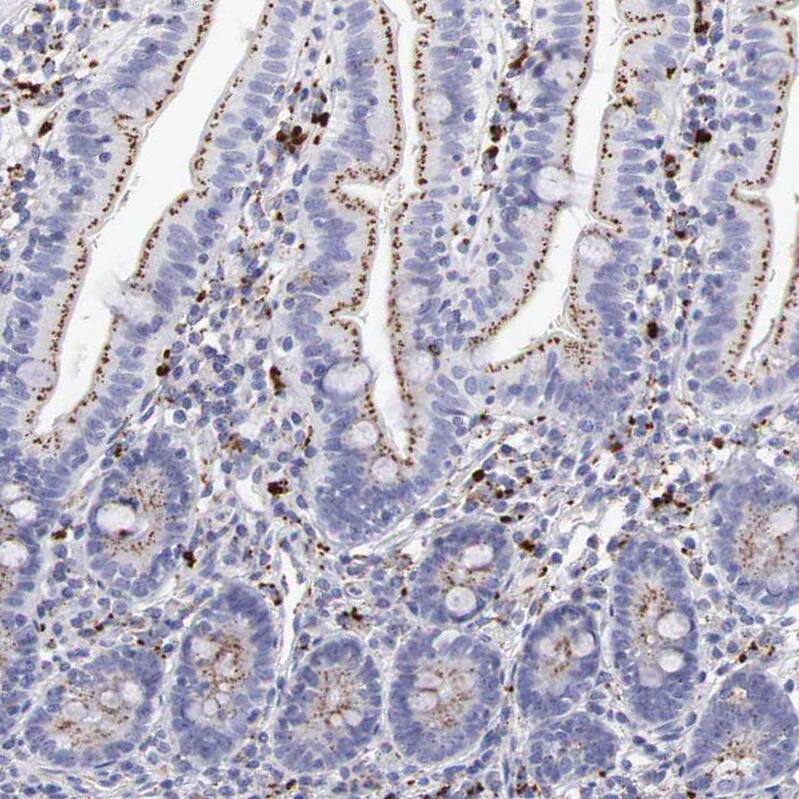 alpha-Galactosidase A/GLA Antibody - BSA Free Immunohistochemistry-Paraffin: alpha-Galactosidase A/GLA Antibody - BSA Free [NBP1-89796]