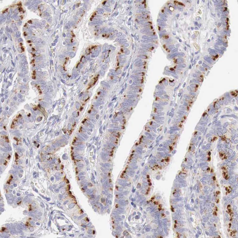 alpha-Galactosidase A/GLA Antibody - BSA Free Immunohistochemistry-Paraffin: alpha-Galactosidase A/GLA Antibody - BSA Free [NBP1-89796]