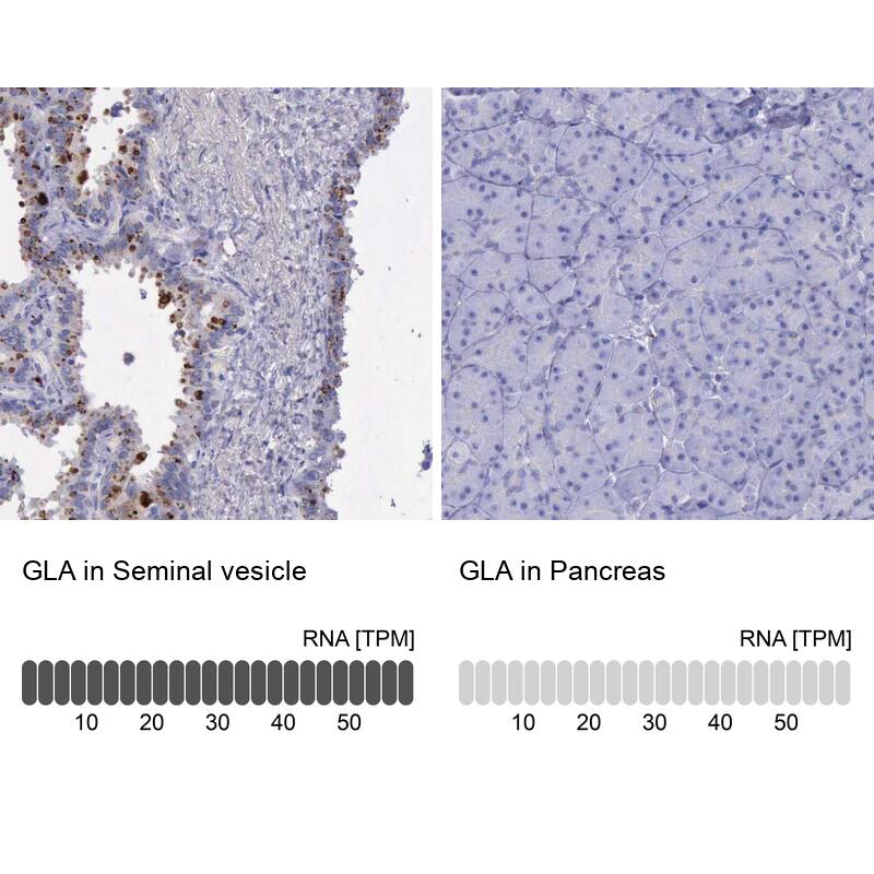 alpha-Galactosidase A/GLA Antibody - BSA Free Immunohistochemistry-Paraffin: alpha-Galactosidase A/GLA Antibody - BSA Free [NBP1-89797]