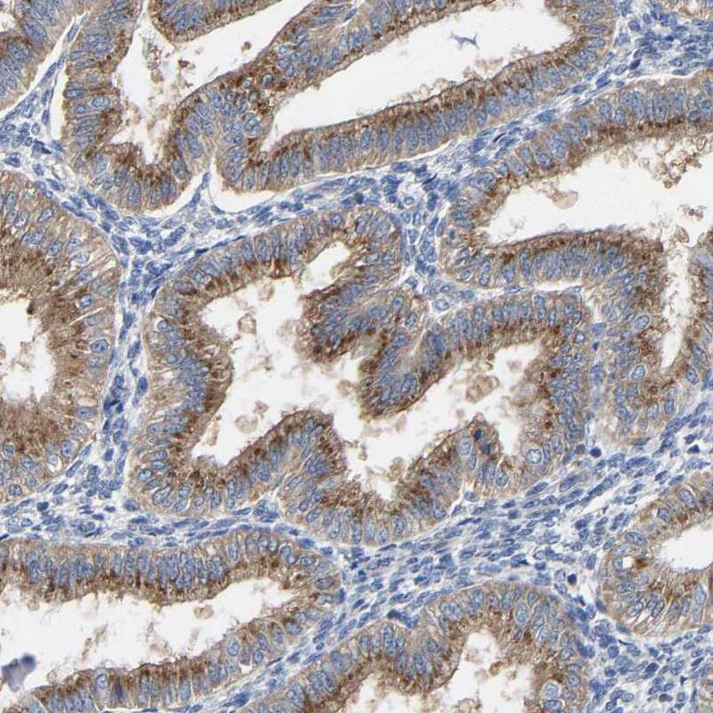 GADD34 Antibody - BSA Free Immunohistochemistry-Paraffin: GADD34 Antibody - BSA Free [NBP1-89800]