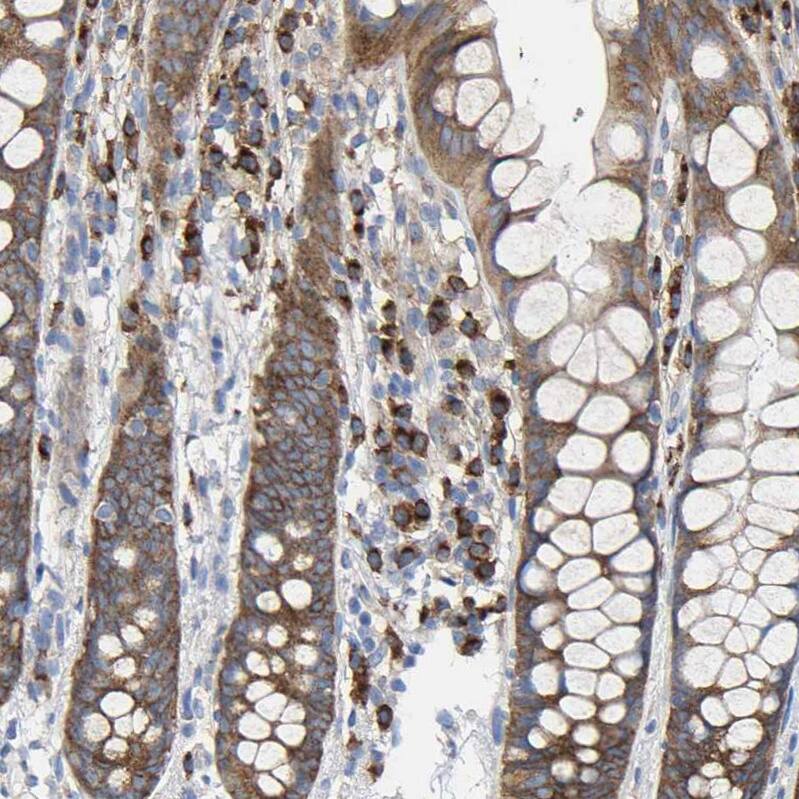 GADD34 Antibody - BSA Free Immunohistochemistry-Paraffin: GADD34 Antibody - BSA Free [NBP1-89800]