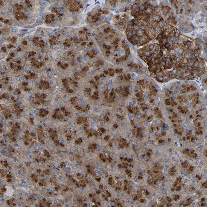 GADD34 Antibody - BSA Free Immunohistochemistry-Paraffin: GADD34 Antibody - BSA Free [NBP1-89800]