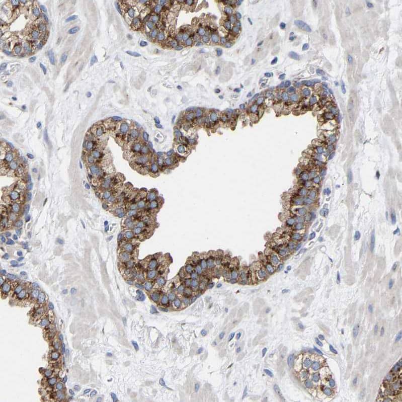 GADD34 Antibody - BSA Free Immunohistochemistry-Paraffin: GADD34 Antibody - BSA Free [NBP1-89800]