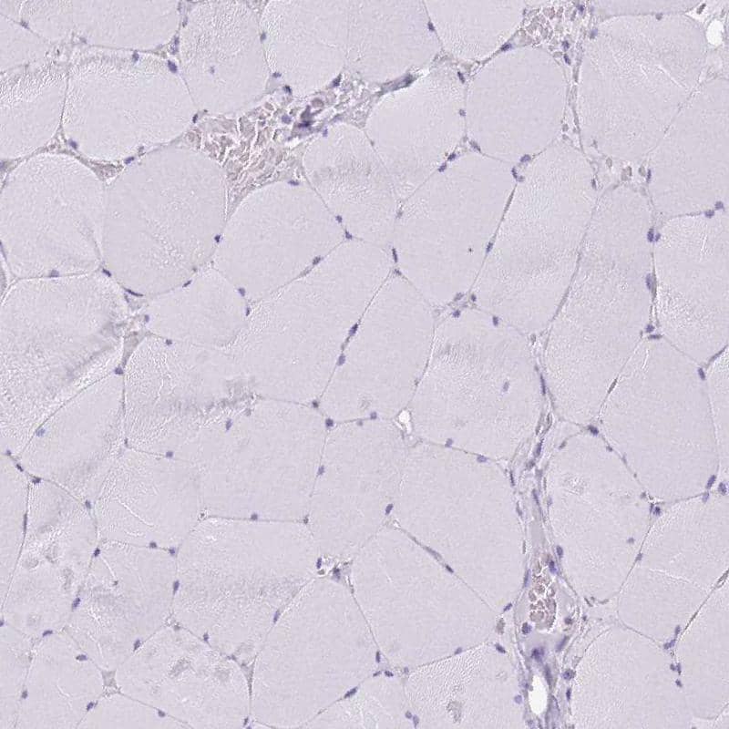 GAT-1/SLC6A1 Antibody - BSA Free Immunohistochemistry-Paraffin: GAT-1/SLC6A1 Antibody - BSA Free [NBP1-89802]