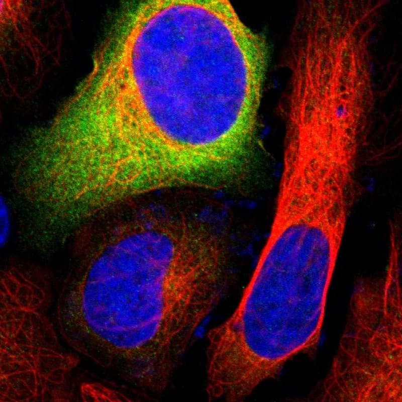 Glucose 6 Phosphate Dehydrogenase Antibody - BSA Free Immunocytochemistry/ Immunofluorescence: Glucose 6 Phosphate Dehydrogenase Antibody - BSA Free [NBP1-89804]