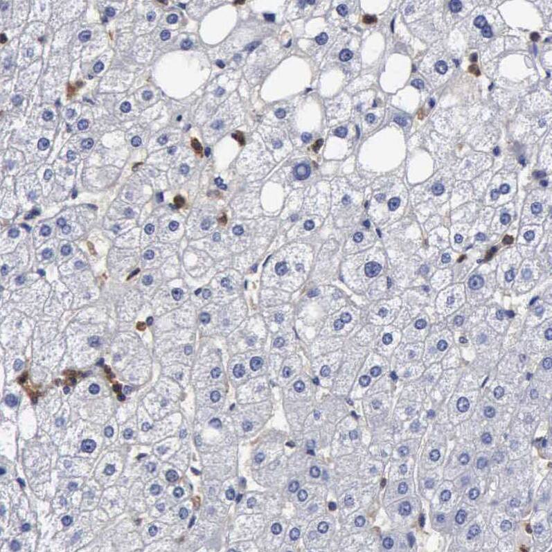 Glucose 6 Phosphate Dehydrogenase Antibody - BSA Free Immunohistochemistry-Paraffin: Glucose 6 Phosphate Dehydrogenase Antibody - BSA Free [NBP1-89804]