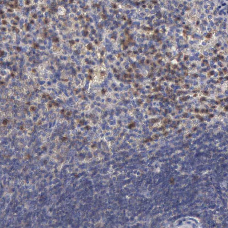 Glucose 6 Phosphate Dehydrogenase Antibody - BSA Free Immunohistochemistry-Paraffin: Glucose 6 Phosphate Dehydrogenase Antibody - BSA Free [NBP1-89804]