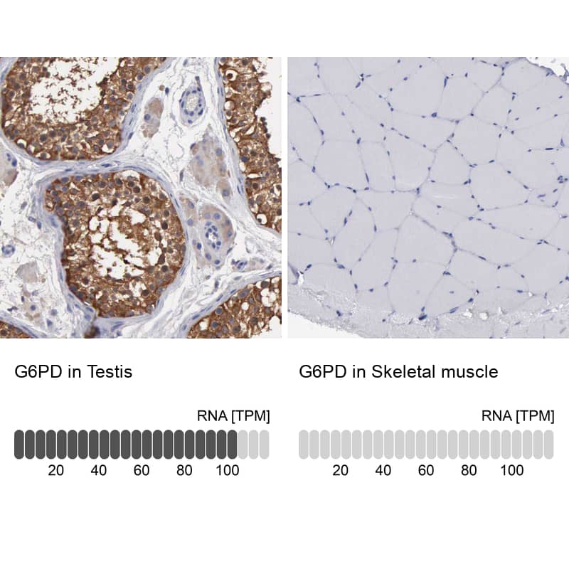 Glucose 6 Phosphate Dehydrogenase Antibody - BSA Free Immunohistochemistry-Paraffin: Glucose 6 Phosphate Dehydrogenase Antibody - BSA Free [NBP1-89804]
