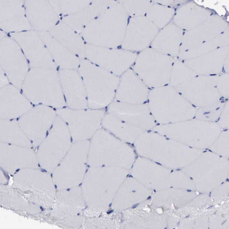Glucose 6 Phosphate Dehydrogenase Antibody - BSA Free Immunohistochemistry-Paraffin: Glucose 6 Phosphate Dehydrogenase Antibody - BSA Free [NBP1-89804]