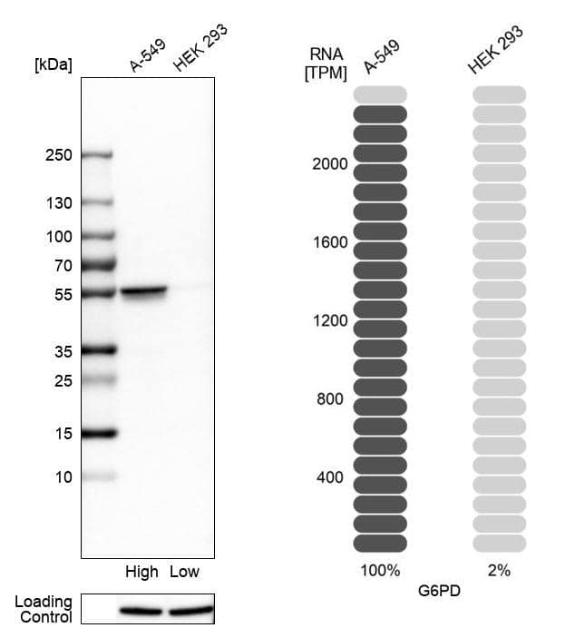 Glucose 6 Phosphate Dehydrogenase Antibody - BSA Free Western Blot: Glucose 6 Phosphate Dehydrogenase Antibody - BSA Free [NBP1-89804]