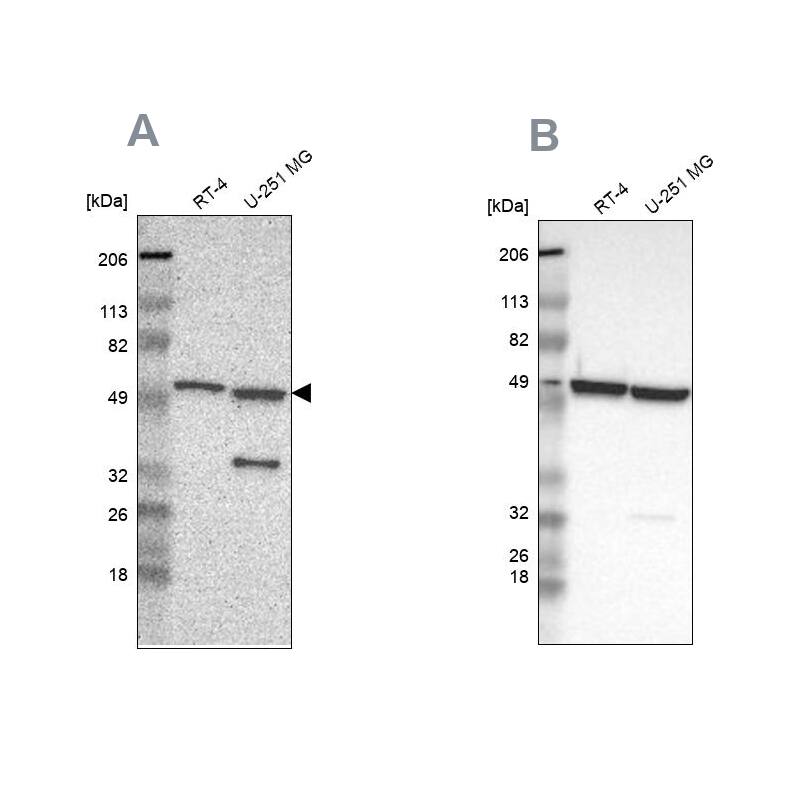 Glucose 6 Phosphate Dehydrogenase Antibody - BSA Free Western Blot: Glucose 6 Phosphate Dehydrogenase Antibody - BSA Free [NBP1-89805]