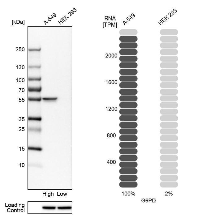 Glucose 6 Phosphate Dehydrogenase Antibody - BSA Free Western Blot: Glucose 6 Phosphate Dehydrogenase Antibody - BSA Free [NBP1-89805]