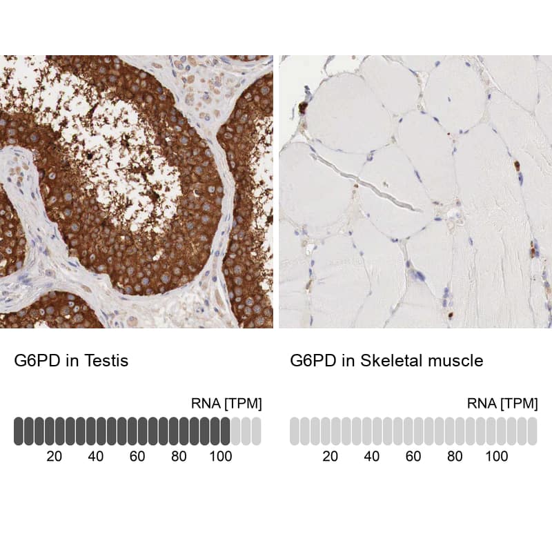 Glucose 6 Phosphate Dehydrogenase Antibody - BSA Free Immunohistochemistry-Paraffin: Glucose 6 Phosphate Dehydrogenase Antibody - BSA Free [NBP1-89805]