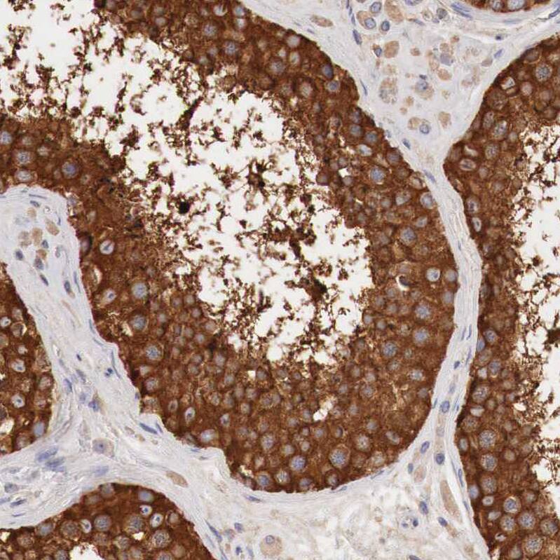 Glucose 6 Phosphate Dehydrogenase Antibody - BSA Free Immunohistochemistry-Paraffin: Glucose 6 Phosphate Dehydrogenase Antibody - BSA Free [NBP1-89805]