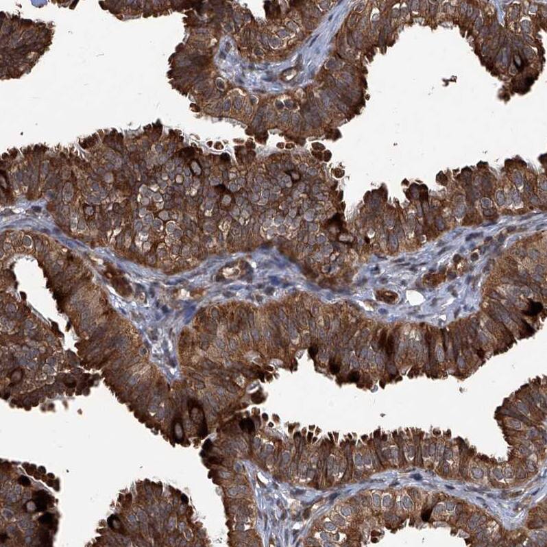 G2A/GPR132 Antibody - BSA Free Immunohistochemistry-Paraffin: G2A/GPR132 Antibody - BSA Free [NBP1-89807]