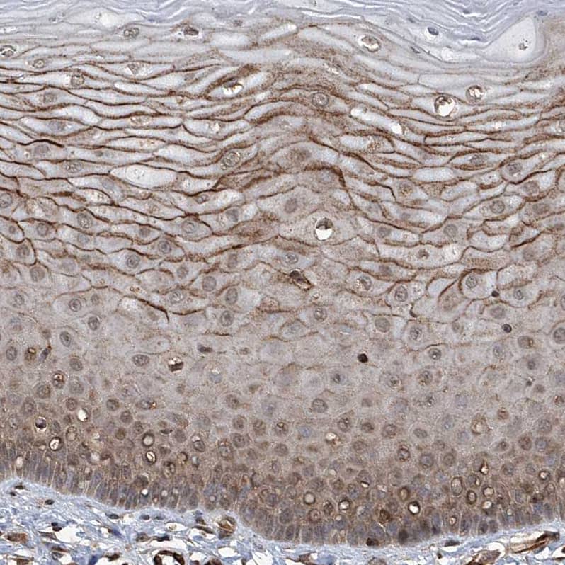 G2A/GPR132 Antibody - BSA Free Immunohistochemistry-Paraffin: G2A/GPR132 Antibody - BSA Free [NBP1-89807]