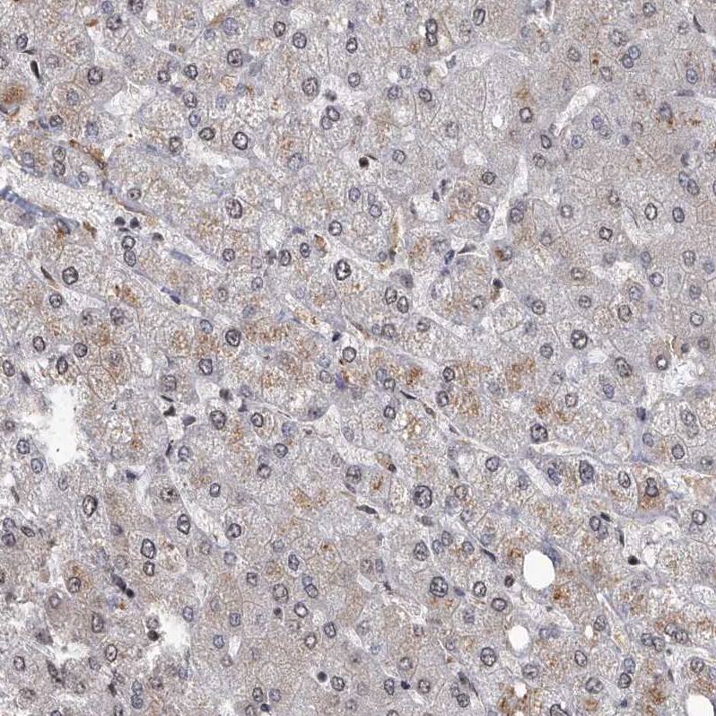 G2A/GPR132 Antibody - BSA Free Immunohistochemistry-Paraffin: G2A/GPR132 Antibody - BSA Free [NBP1-89807]