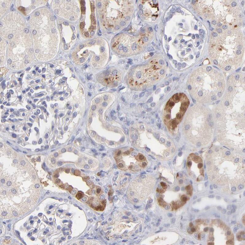 Factor XIIIb Antibody - BSA Free Immunohistochemistry-Paraffin: Factor XIIIb Antibody - BSA Free [NBP1-89811]