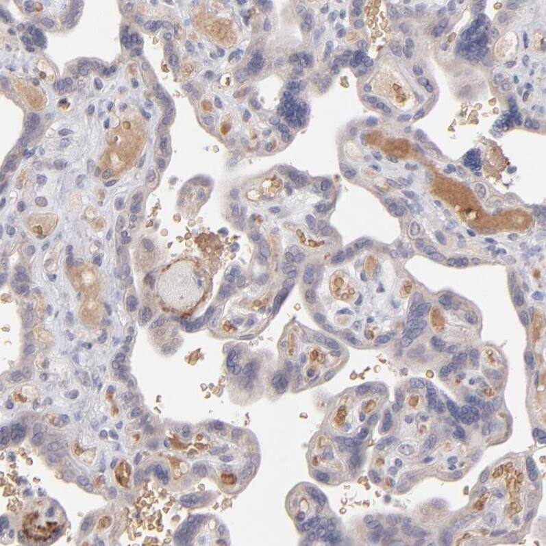 Factor XIIIb Antibody - BSA Free Immunohistochemistry-Paraffin: Factor XIIIb Antibody - BSA Free [NBP1-89811]