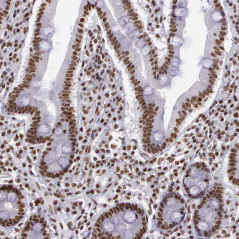 hnRNP H2 Antibody - BSA Free Immunohistochemistry-Paraffin: hnRNP H2 Antibody - BSA Free [NBP1-89817]