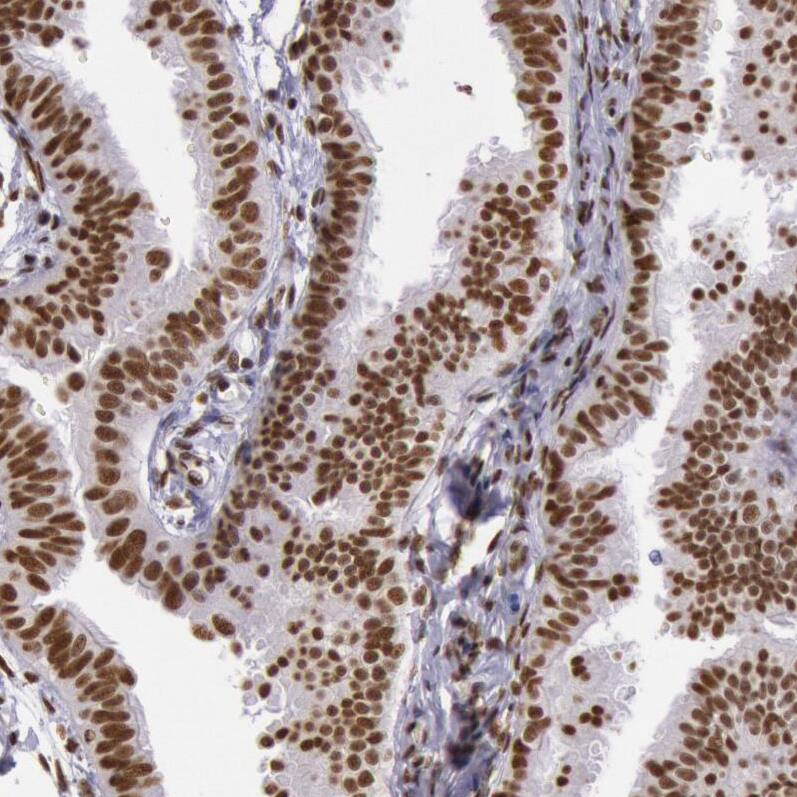 hnRNP H2 Antibody - BSA Free Immunohistochemistry-Paraffin: hnRNP H2 Antibody - BSA Free [NBP1-89817]
