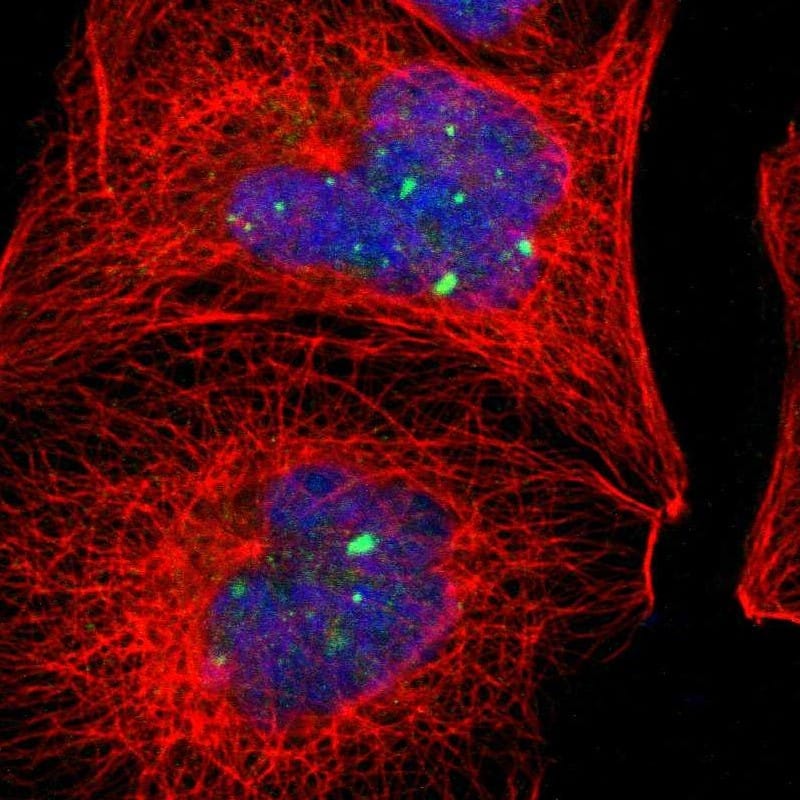 Alpha Actinin 4 Antibody - BSA Free Immunocytochemistry/ Immunofluorescence: Alpha Actinin 4 Antibody [NBP1-89818]