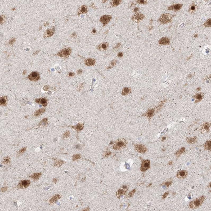 RBFOX3/NeuN Antibody - BSA Free Immunohistochemistry-Paraffin: RBFOX3/NeuN Antibody - BSA Free [NBP1-89821]