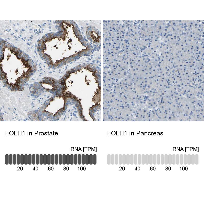 PSMA/FOLH1/NAALADase I Antibody - BSA Free Immunohistochemistry-Paraffin: PSMA/FOLH1/NAALADase I Antibody - BSA Free [NBP1-89822]