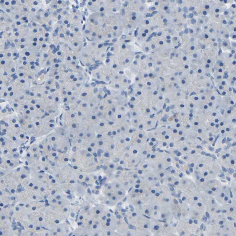 PSMA/FOLH1/NAALADase I Antibody - BSA Free Immunohistochemistry-Paraffin: PSMA/FOLH1/NAALADase I Antibody - BSA Free [NBP1-89822]