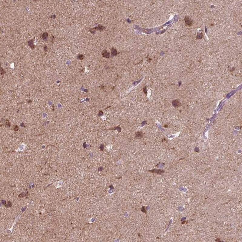 Secretogranin 3 Antibody - BSA Free Immunohistochemistry-Paraffin: Secretogranin 3 Antibody - BSA Free [NBP1-89825]